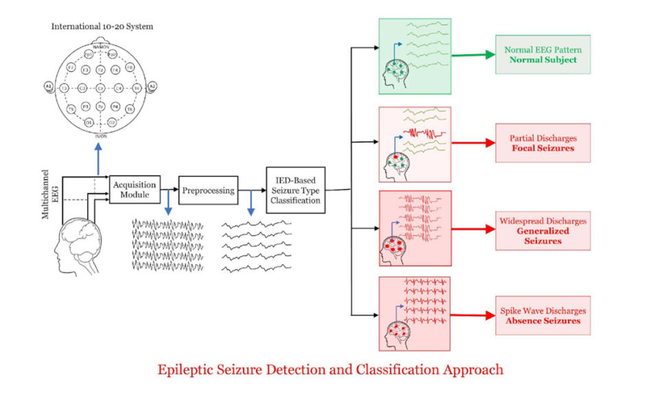 New algorithm for accurate detection of epilepsy